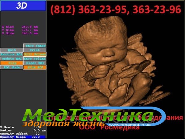   SonoScape S8