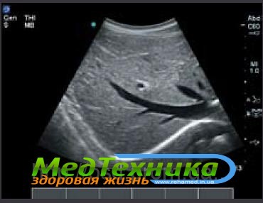 УЗИ аппарат SonoSite M-Turbo
