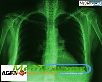Рентгеновская пленка AGFA Curix Ortho HT-G Зеленочувствительная пленка 