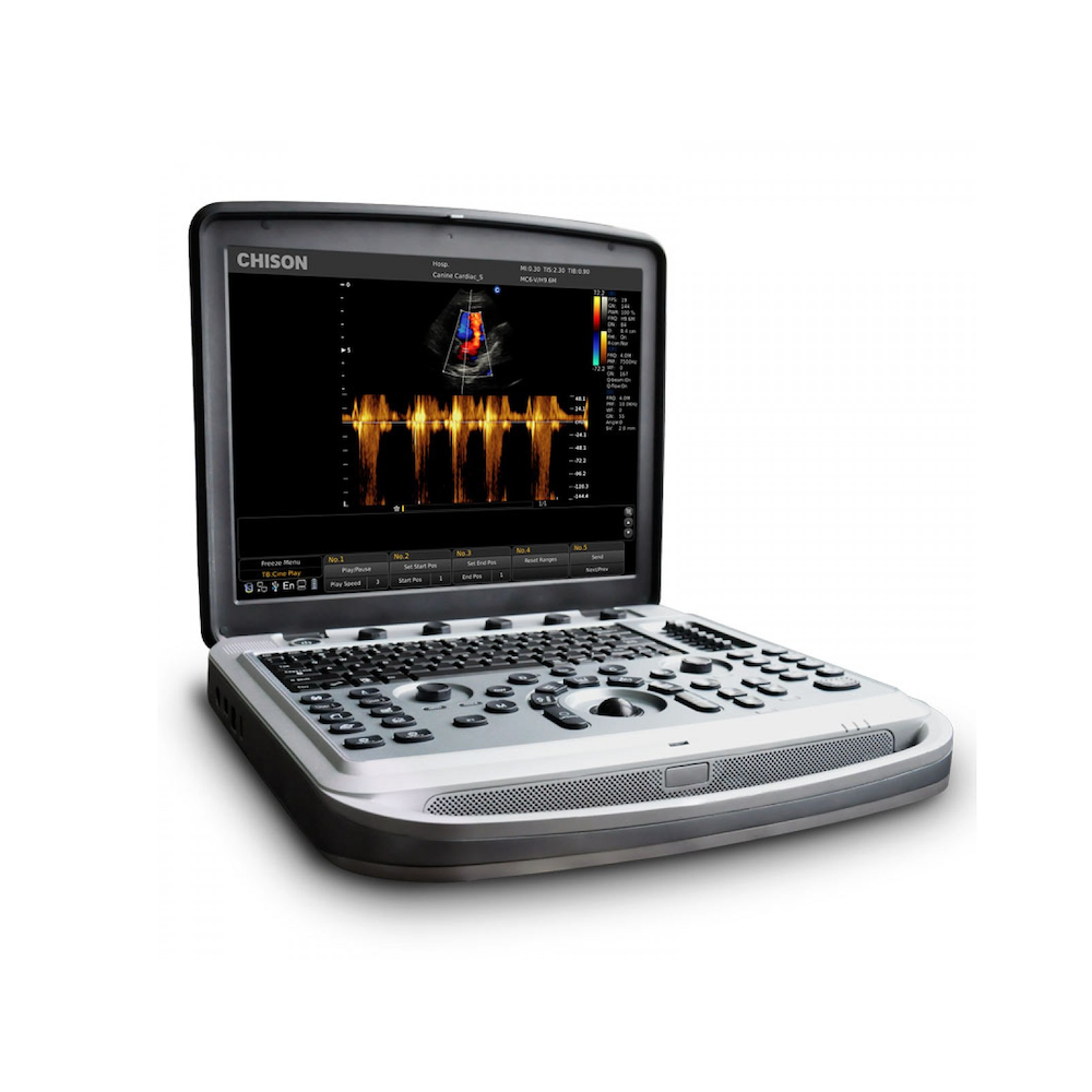 Портативный ультразвуковой аппарат экспертного класса Сhison SonoBook 6