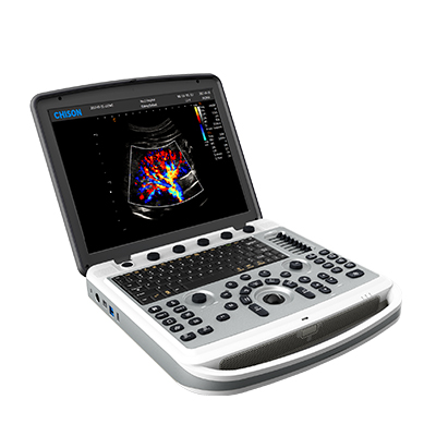 Ультразвуковой аппарат SonoBook 6 (3 датчика)
