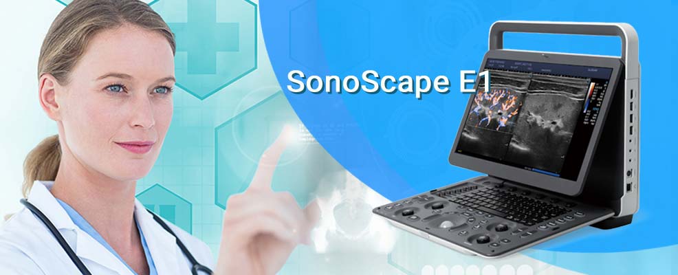 Портативний ультразвуковий сканер SonoScape E1